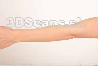 Photo reference of forearm 0001